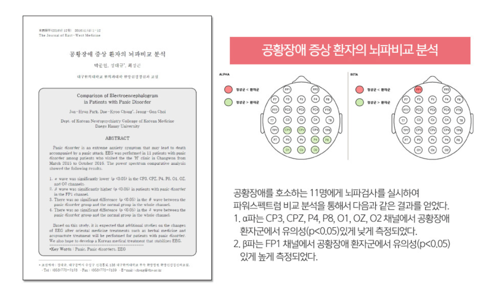 공황장애 및 불안장애 신경정신과 연구 논문